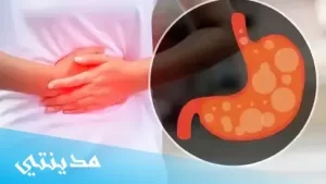 يدخل الهواء للمعدة بسبب ، جميع التفاصيل